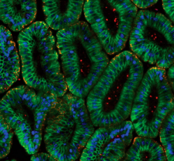 ЭПИТЕЛИАЛЬНЫЕ КЛЕТКИ ИЗБАВЛЯЮТСЯ ОТ СЛАБЕЙШИХ